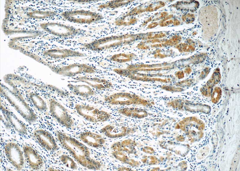 Immunohistochemistry of paraffin-embedded human stomach tissue slide using Catalog No:112808(MRPL1 Antibody) at dilution of 1:50 (under 10x lens)