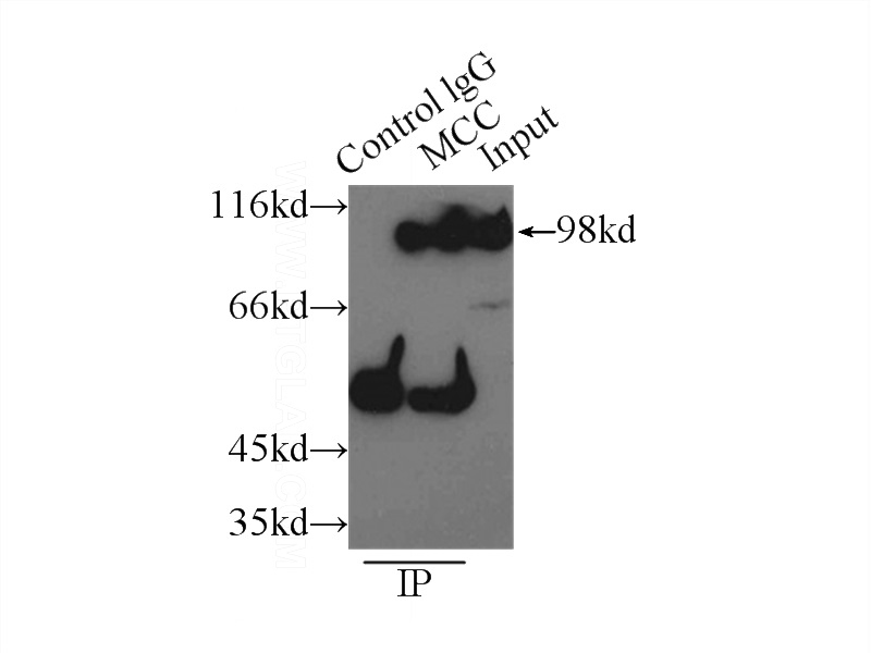IP Result of anti-MCC (IP:Catalog No:112542, 3ug; Detection:Catalog No:112542 1:500) with PC-3 cells lysate 5000ug.