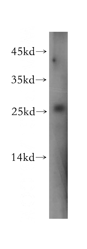 HeLa cells were subjected to SDS PAGE followed by western blot with Catalog No:111028(GLO1 antibody) at dilution of 1:100