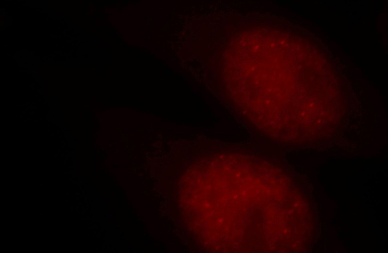 Immunofluorescent analysis of Hela cells, using TERF2IP antibody Catalog No:115948 at 1:25 dilution and Rhodamine-labeled goat anti-rabbit IgG (red).