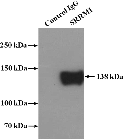 IP Result of anti-SRRM1 (IP:Catalog No:115601, 4ug; Detection:Catalog No:115601 1:300) with HeLa cells lysate 3200ug.