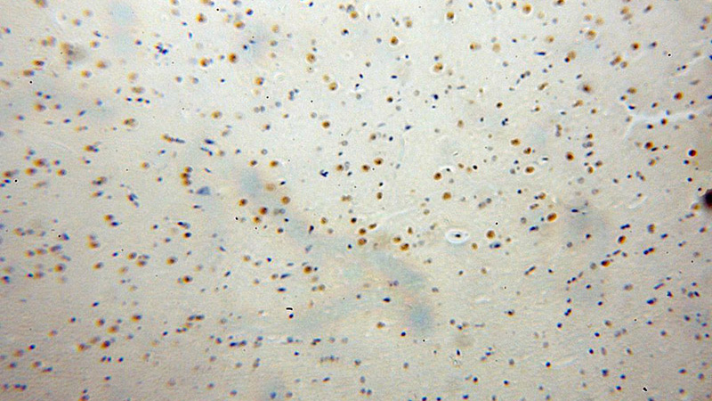 Immunohistochemical of paraffin-embedded human brain using Catalog No:109935(DHX9 antibody) at dilution of 1:100 (under 10x lens)