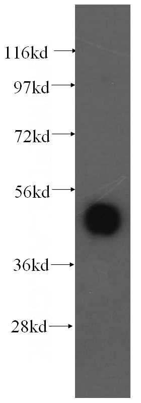 human brain tissue were subjected to SDS PAGE followed by western blot with Catalog No:117068(ATXN10 antibody) at dilution of 1:500