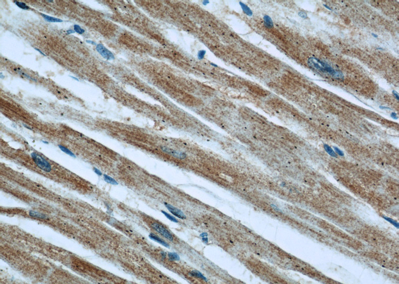 Immunohistochemical of paraffin-embedded human heart using Catalog No:110206(EFEMP2 antibody) at dilution of 1:50 (under 40x lens)