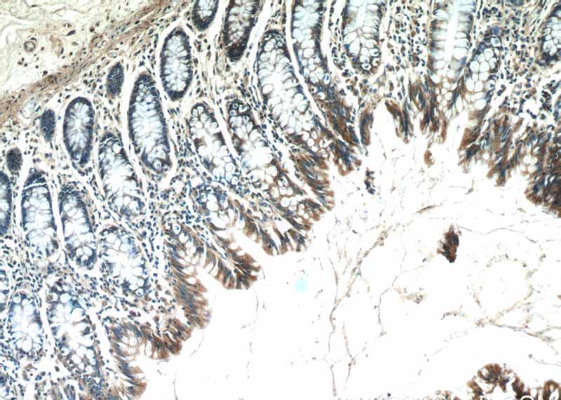 Immunohistochemistry of paraffin-embedded human colon tissue slide using Catalog No:108731(C4orf29 Antibody) at dilution of 1:50 (under 10x lens)