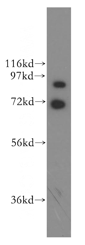 K-562 cells were subjected to SDS PAGE followed by western blot with Catalog No:111213(ADRBK2 antibody) at dilution of 1:400
