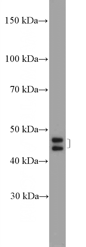 HepG2 cells were subjected to SDS PAGE followed by western blot with Catalog No:117007(ZNF586 Antibody) at dilution of 1:600