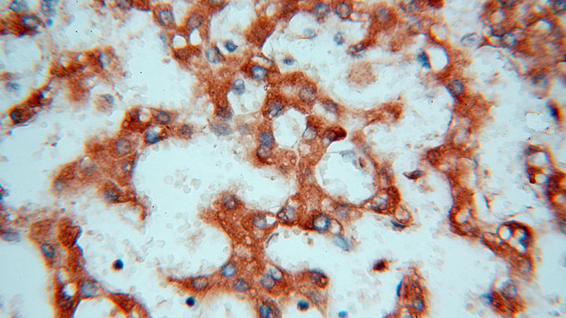 Immunohistochemical of paraffin-embedded human liver using Catalog No:110644(FGL1 antibody) at dilution of 1:100 (under 40x lens)