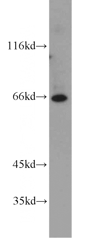 human brain tissue were subjected to SDS PAGE followed by western blot with Catalog No:113898(PIGT antibody) at dilution of 1:800