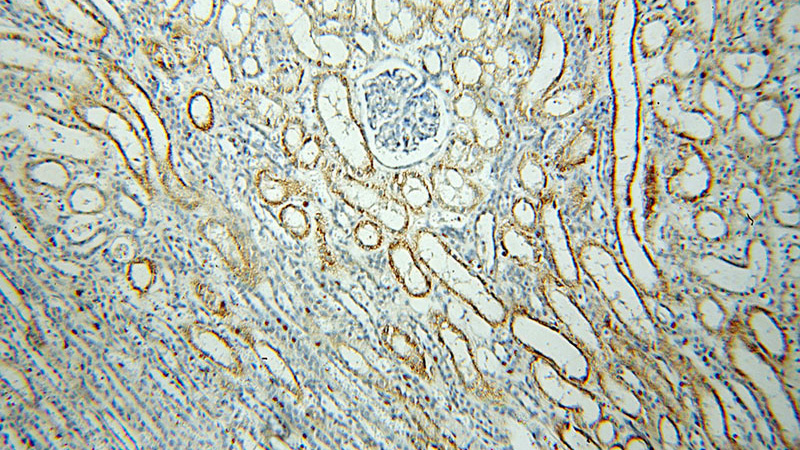 Immunohistochemical of paraffin-embedded human kidney using Catalog No:113402(NUAK2 antibody) at dilution of 1:50 (under 10x lens)