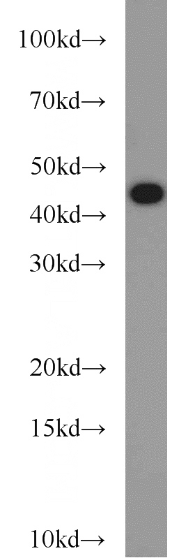 Raji cells were subjected to SDS PAGE followed by western blot with Catalog No:115843(TAL1 antibody) at dilution of 1:1000