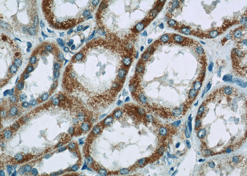Immunohistochemistry of paraffin-embedded human kidney tissue slide using Catalog No:113088(NDUFV3 Antibody) at dilution of 1:50 (under 40x lens)