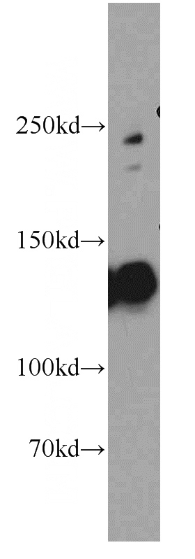 mouse kidney tissue were subjected to SDS PAGE followed by western blot with Catalog No:109317(CGN antibody) at dilution of 1:500