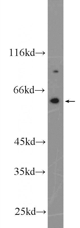 Jurkat cells were subjected to SDS PAGE followed by western blot with Catalog No:113315(NOX5 Antibody) at dilution of 1:1000