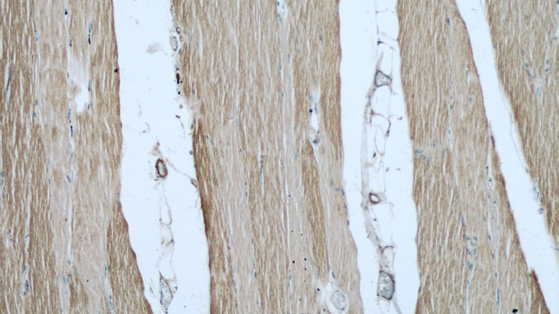 Immunohistochemical of paraffin-embedded human skeletal muscle using Catalog No:112913(MYBPC1 antibody) at dilution of 1:50 (under 10x lens)