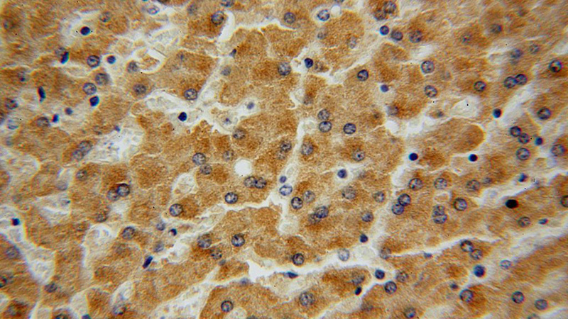 Immunohistochemical of paraffin-embedded human liver using Catalog No:116558(UGT2B4 antibody) at dilution of 1:100 (under 40x lens)