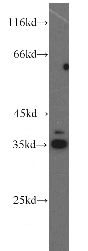 COLO 320 cells were subjected to SDS PAGE followed by western blot with Catalog No:109921(DHRS1 antibody) at dilution of 1:800