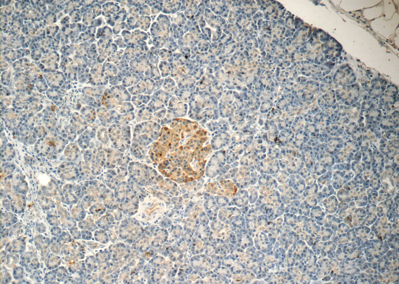 Immunohistochemistry of paraffin-embedded human pancreas tissue slide using Catalog No:115614(SSTR3 Antibody) at dilution of 1:50 (under 10x lens)