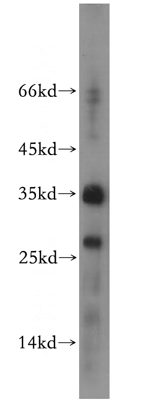 HeLa cells were subjected to SDS PAGE followed by western blot with Catalog No:114814(RPL13A antibody) at dilution of 1:400