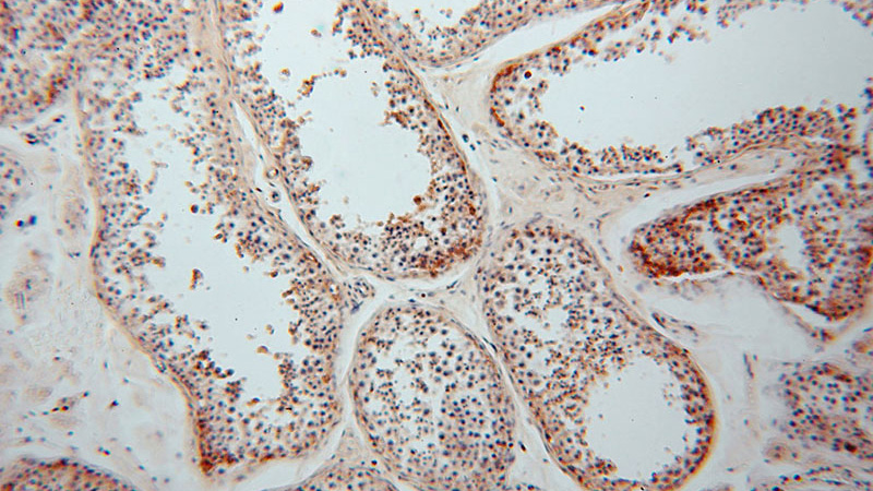 Immunohistochemical of paraffin-embedded human testis using Catalog No:113275(NRD1 antibody) at dilution of 1:50 (under 10x lens)
