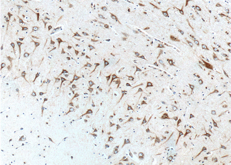 Immunohistochemistry of paraffin-embedded human brain tissue slide using Catalog No:111074(GPR111 Antibody) at dilution of 1:100 (under 10x lens).
