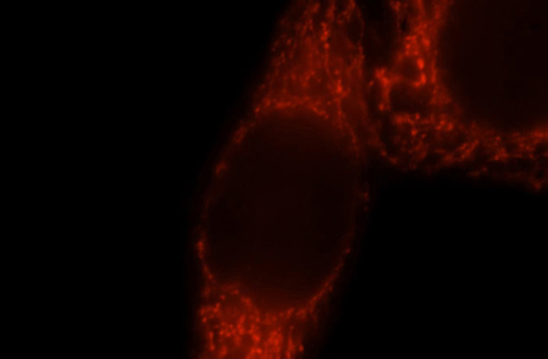 Immunofluorescent analysis of MCF-7 cells, using GSTA3 antibody Catalog No:111181 at 1:25 dilution and Rhodamine-labeled goat anti-rabbit IgG (red).