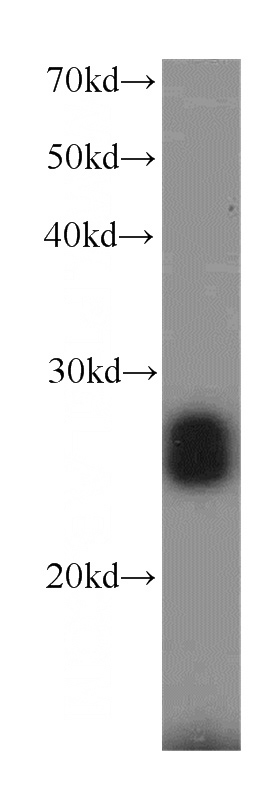mouse lung tissue were subjected to SDS PAGE followed by western blot with Catalog No:114644(RGS17 antibody) at dilution of 1:1000