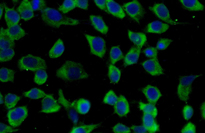 Immunofluorescent analysis of (-20oc Ethanol) fixed A431 cells using Catalog No:111201(GRB7 Antibody) at dilution of 1:25 and Alexa Fluor 488-congugated AffiniPure Goat Anti-Rabbit IgG(H+L)