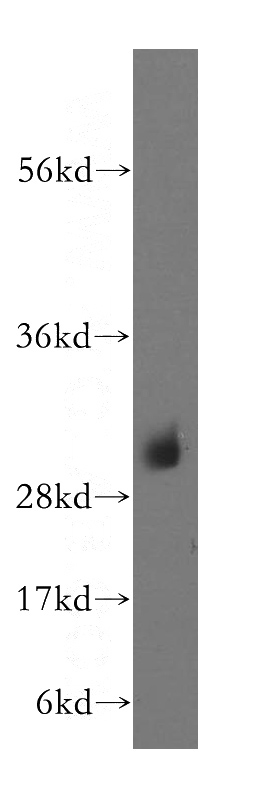 human heart tissue were subjected to SDS PAGE followed by western blot with Catalog No:113082(NDUFS3 antibody) at dilution of 1:300