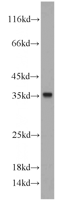 HepG2 cells were subjected to SDS PAGE followed by western blot with Catalog No:109657(CYB5R3 antibody) at dilution of 1:1000
