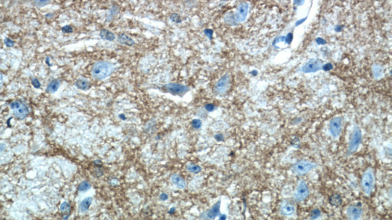 Immunohistochemistry of paraffin-embedded mouse brain tissue slide using Catalog No:112064(KCNJ10 Antibody) at dilution of 1:50 (under 40x lens)