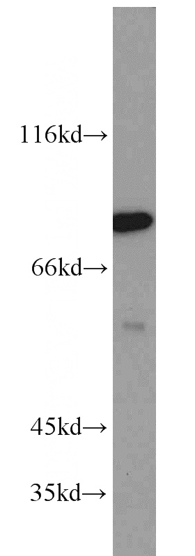 Jurkat cells were subjected to SDS PAGE followed by western blot with Catalog No:113738(PCIF1 antibody) at dilution of 1:800