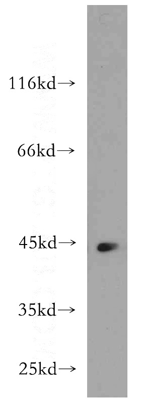 mouse brain tissue were subjected to SDS PAGE followed by western blot with Catalog No:112106(KLHL35 antibody) at dilution of 1:500