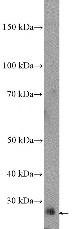 mouse embryo tissue were subjected to SDS PAGE followed by western blot with Catalog No:112233(LIN28B Antibody) at dilution of 1:300