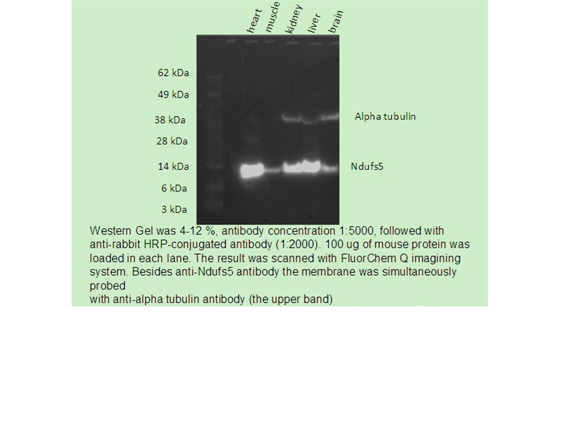 WB result of Catalog No:113083(anti-NDUFS5) in mouse Tissue by Dr. Pawel Grzmil.