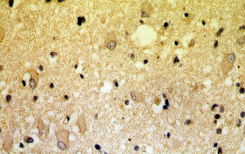 Immunohistochemical of paraffin-embedded human brain using Catalog No:112074(KLC2 antibody) at dilution of 1:100 (under 40x lens)