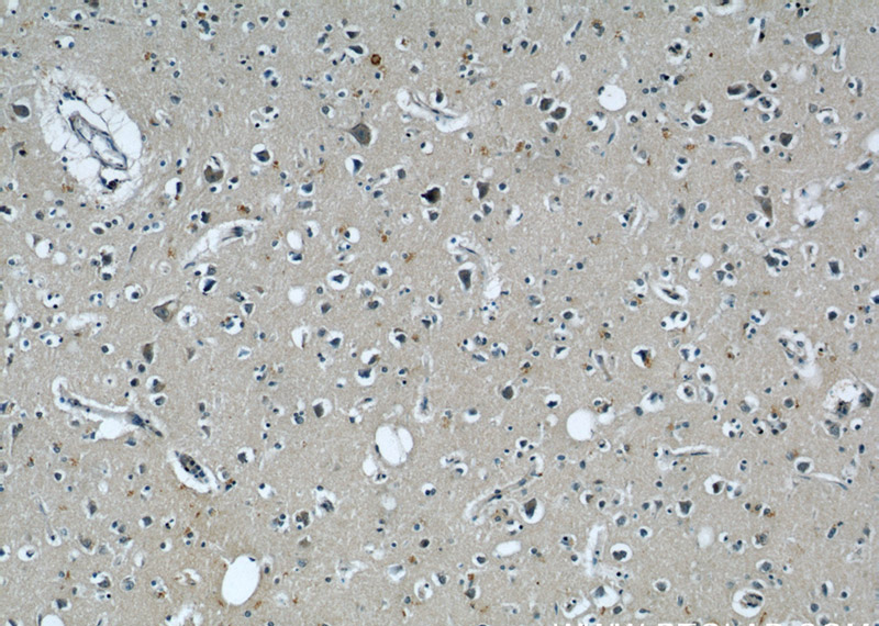Immunohistochemical of paraffin-embedded human brain using Catalog No:107615(STX6 antibody) at dilution of 1:50 (under 10x lens)