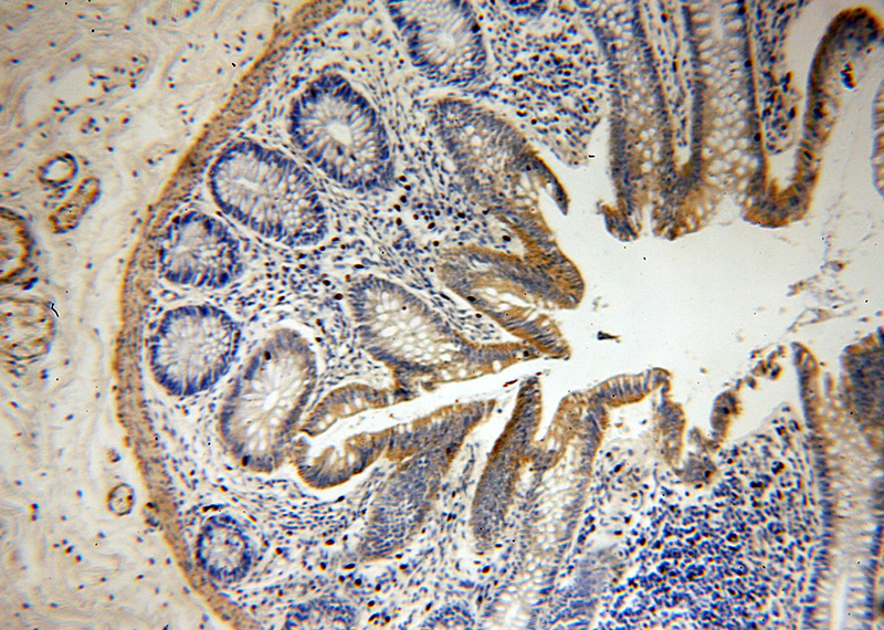 Immunohistochemical of paraffin-embedded human colon using Catalog No:116884(YES1-Specific antibody) at dilution of 1:50 (under 10x lens)