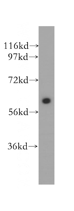 human brain tissue were subjected to SDS PAGE followed by western blot with Catalog No:115373(SLC38A1 antibody) at dilution of 1:500