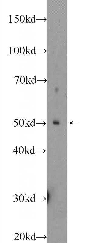 mouse brain tissue were subjected to SDS PAGE followed by western blot with Catalog No:113585(Parkin Antibody) at dilution of 1:300