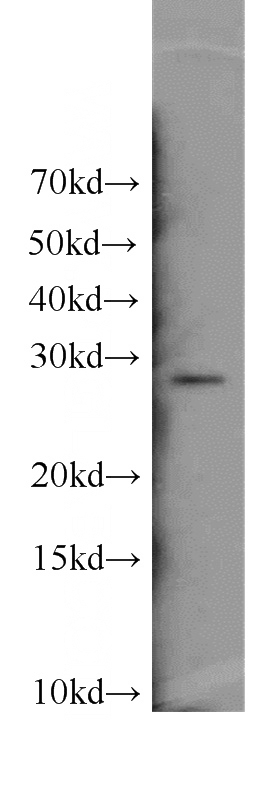 HL-60 cells were subjected to SDS PAGE followed by western blot with Catalog No:110256(ENOPH1 antibody) at dilution of 1:300
