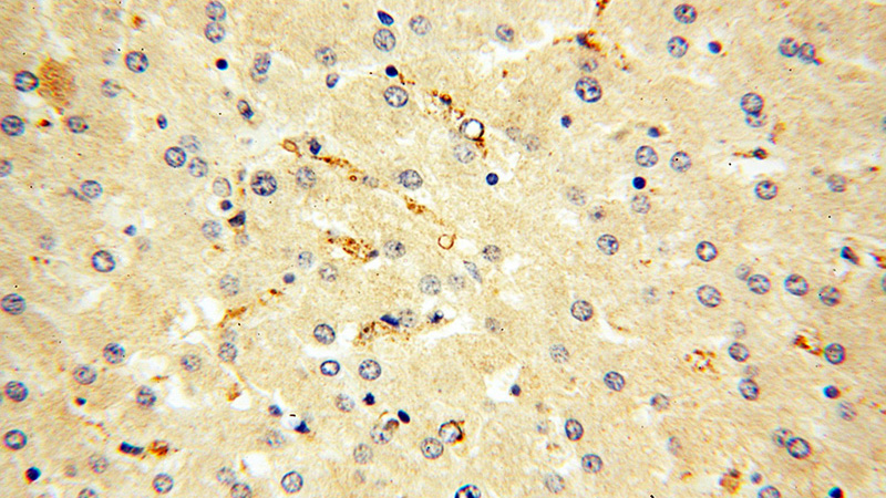 Immunohistochemical of paraffin-embedded human liver using Catalog No:110249(Endostatin, COL18A1 antibody) at dilution of 1:50 (under 40x lens)