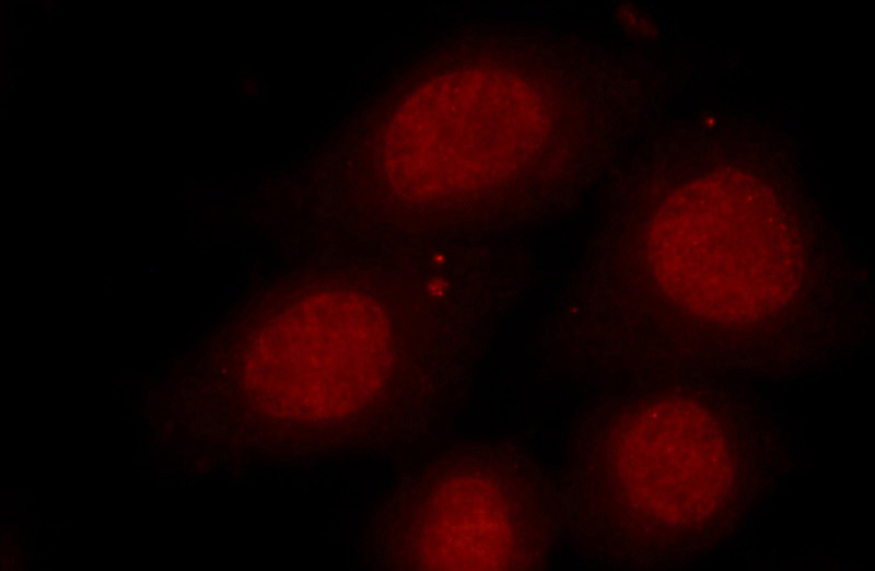 Immunofluorescent analysis of HepG2 cells using Catalog No:111372(HDAC1-specific Antibody) at dilution of 1:25 and Rhodamine-Goat anti-Rabbit IgG