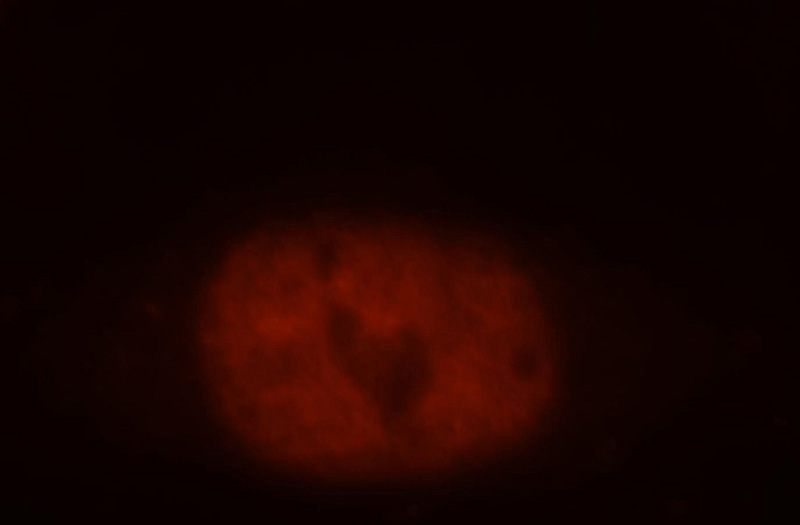 Immunofluorescent analysis of Hela cells, using ADNP antibody Catalog No:107796 at 1:25 dilution and Rhodamine-labeled goat anti-rabbit IgG (red).