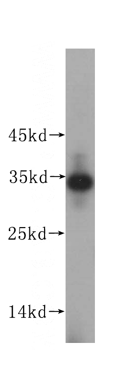 HeLa cells were subjected to SDS PAGE followed by western blot with Catalog No:111759(IMP4 antibody) at dilution of 1:500