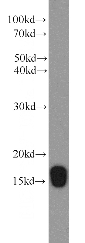 human placenta tissue were subjected to SDS PAGE followed by western blot with Catalog No:111208(GRIM19 antibody) at dilution of 1:800