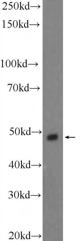Neuro-2a cells were subjected to SDS PAGE followed by western blot with Catalog No:115714(STK25 Antibody) at dilution of 1:600