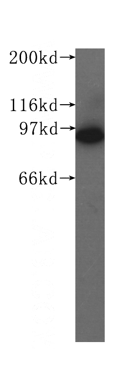 K-562 cells were subjected to SDS PAGE followed by western blot with Catalog No:107511(RRM1 antibody) at dilution of 1:500