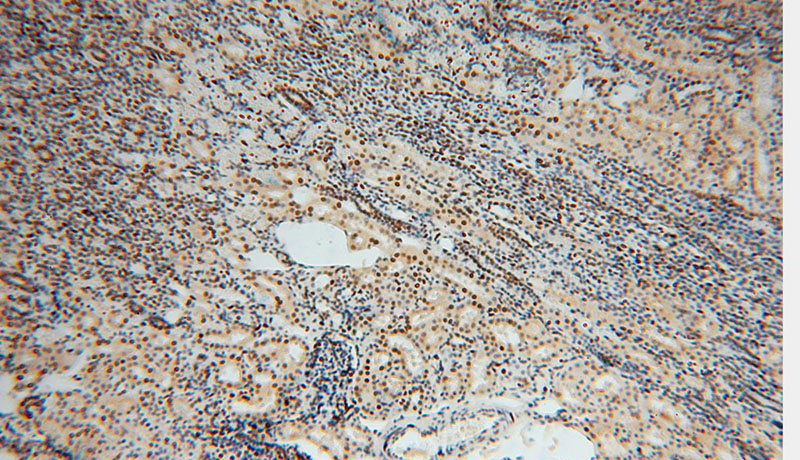 Immunohistochemical of paraffin-embedded human kidney using Catalog No:107258(HDGF antibody) at dilution of 1:50 (under 10x lens)
