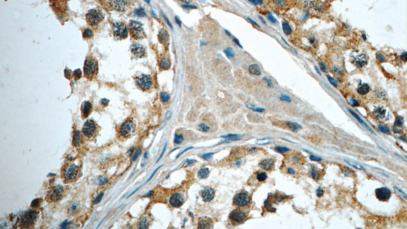Immunohistochemistry of paraffin-embedded human testis tissue slide using Catalog No:111663(IFT122 Antibody) at dilution of 1:50 (under 40x lens)